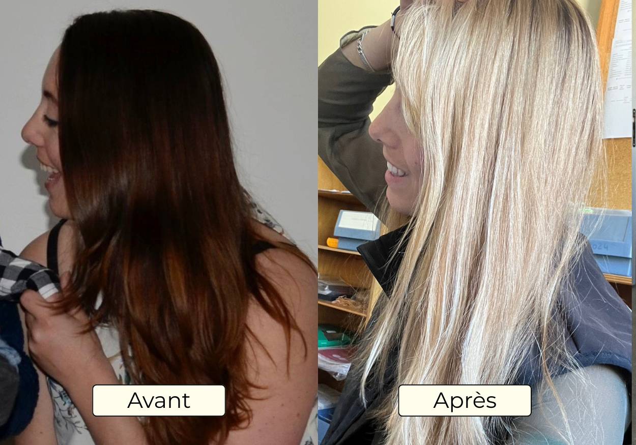 Avant Apres OMAD'S - Resultat 10