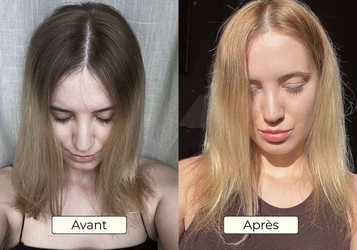 Avant Apres OMAD'S - Resultat 12