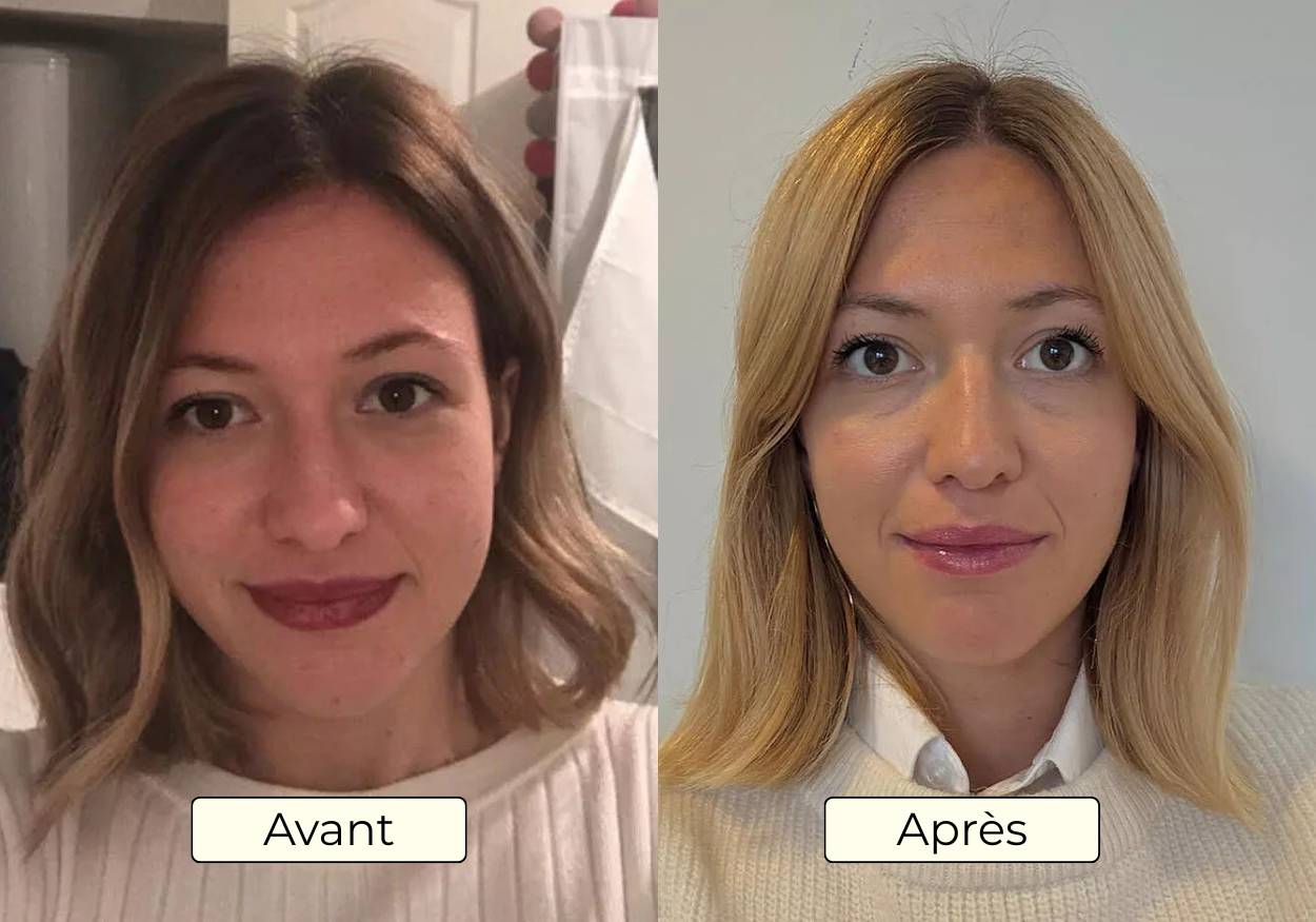 Avant Apres OMAD'S - Resultat 16