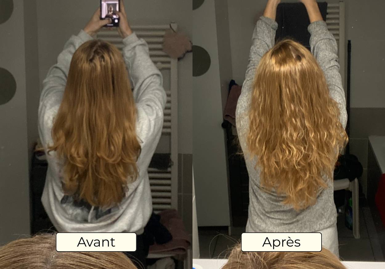 Avant Apres OMAD'S - Resultat 17