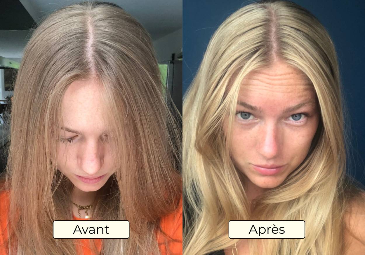 Avant Apres OMAD'S - Resultat 5