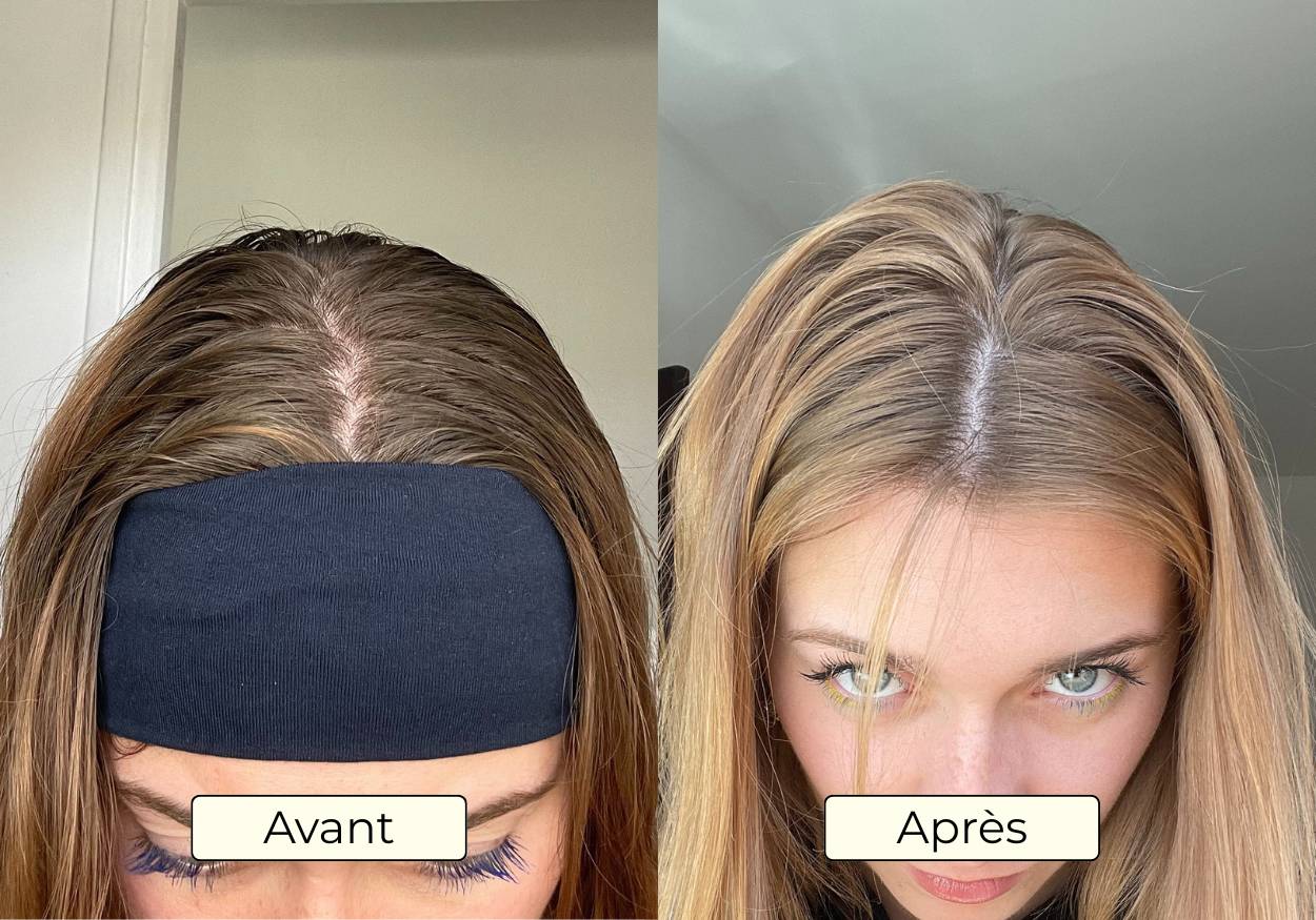 Avant Apres OMAD'S - Resultat 7