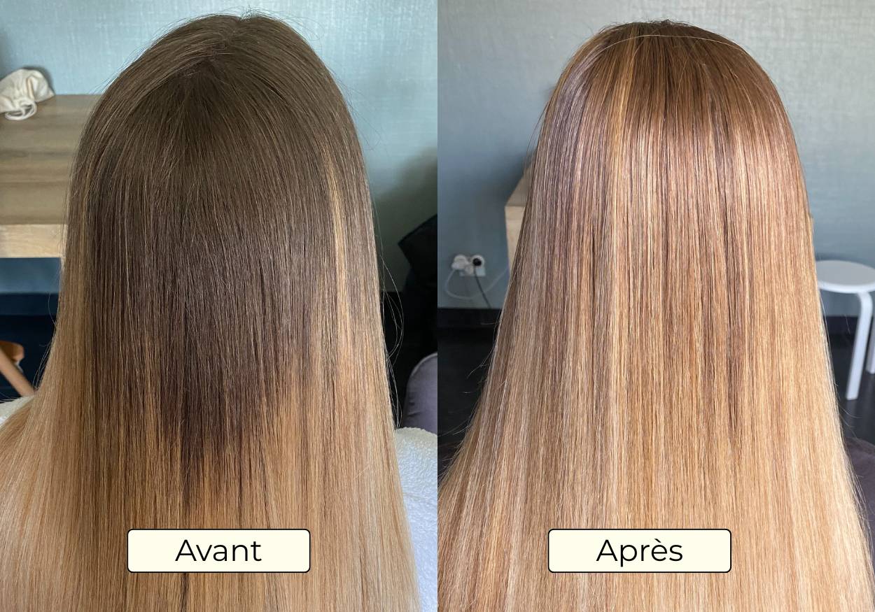 Avant Apres OMAD'S - Resultat 8