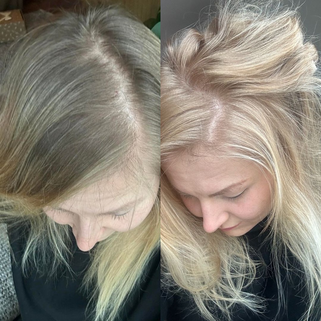 Avant Apres OMAD'S - Blonde 9