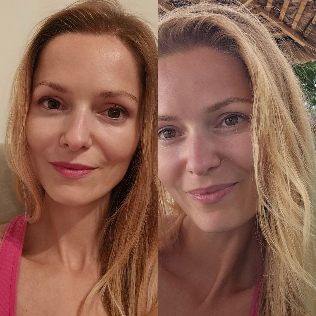 Avant Apres OMAD'S - Blonde 11