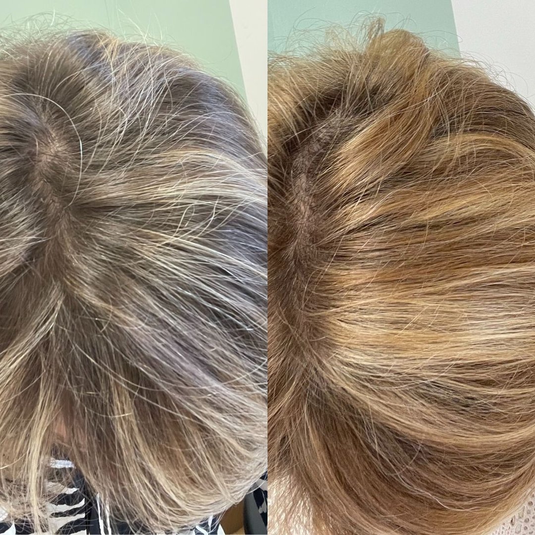 Avant Apres OMAD'S - Blonde 27