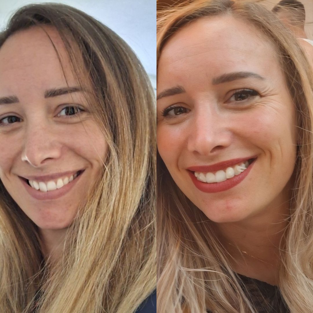 Avant Apres OMAD'S - Blonde 33