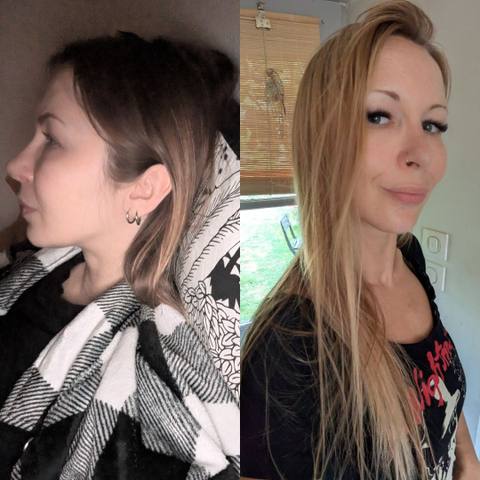 Antes y después de una clienta de OMAD'S