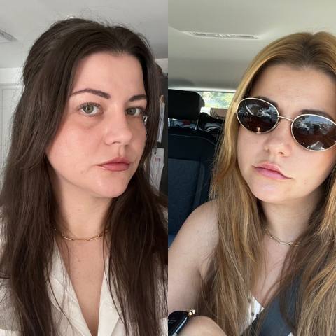Antes y después de una clienta de OMAD'S