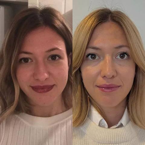 Antes y después de una clienta de OMAD'S