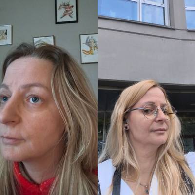 Przed i po u klientki OMAD'S