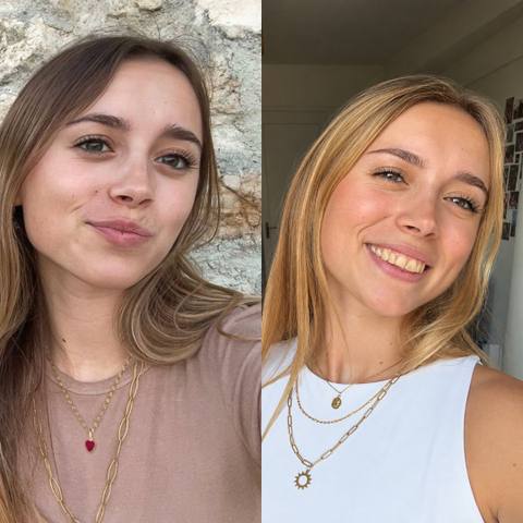 Antes y después de una clienta de OMAD'S